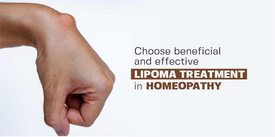 lipoma treatment in Homeopathy