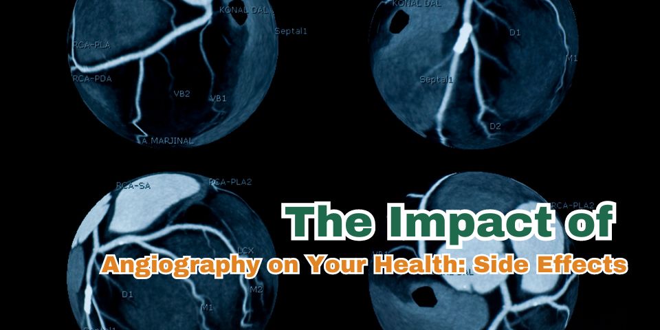 Angiography on Your Health Side Effects