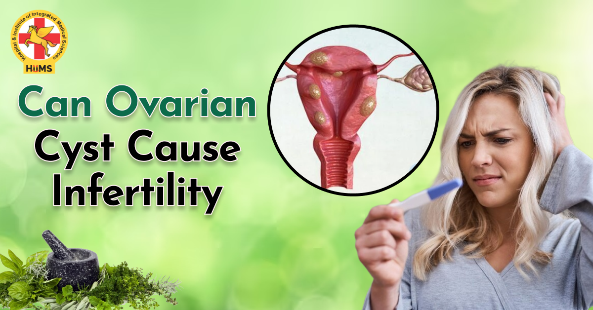 Can Ovarian Cysts Cause Infertility