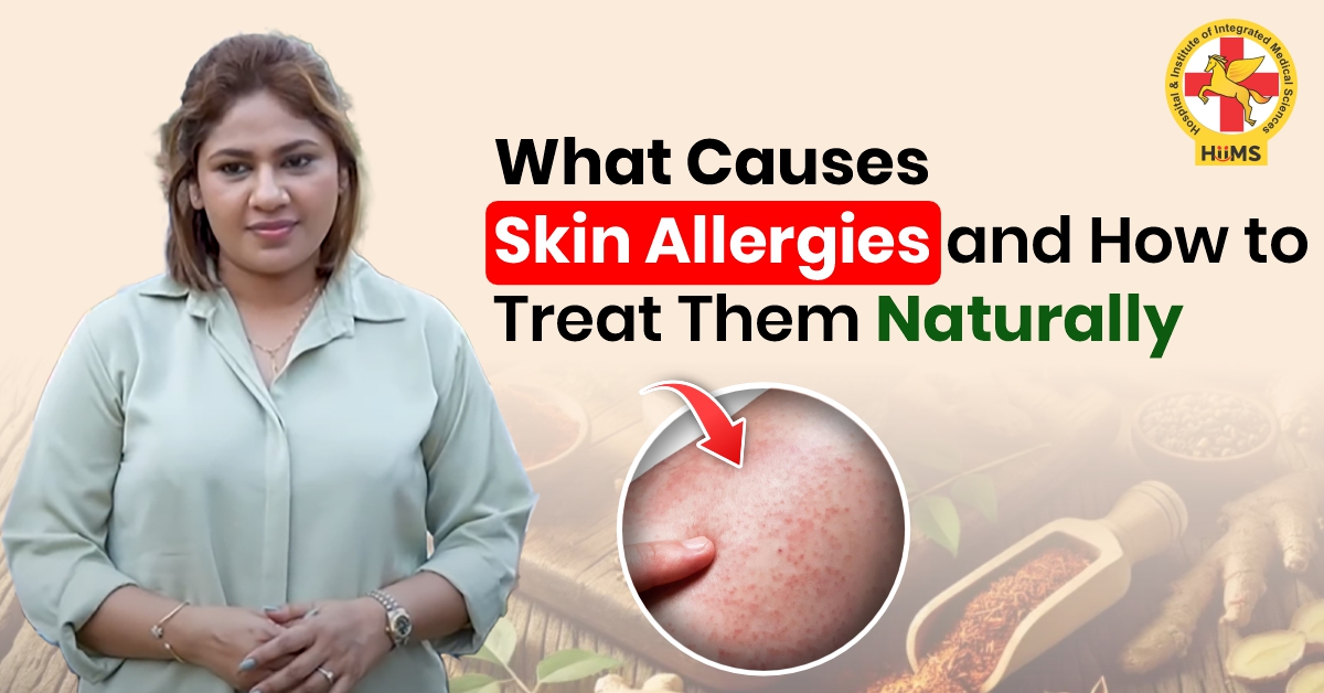 What Causes Skin Allergies and How to Treat Them Naturally