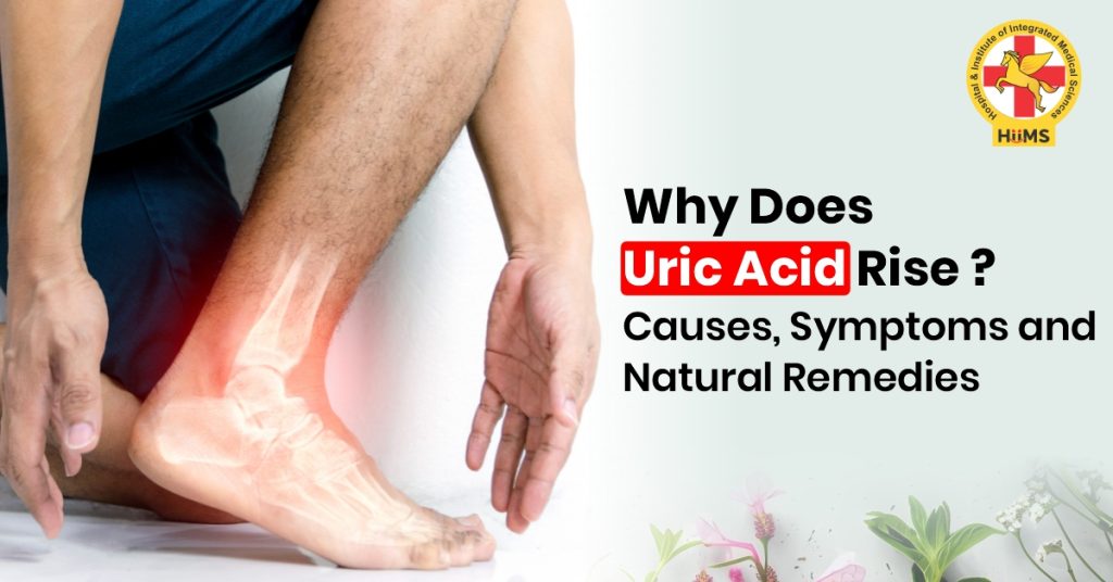 Uric acid causes and symptoms