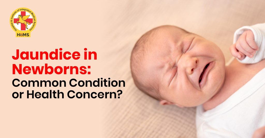 Is newborn jaundice normal