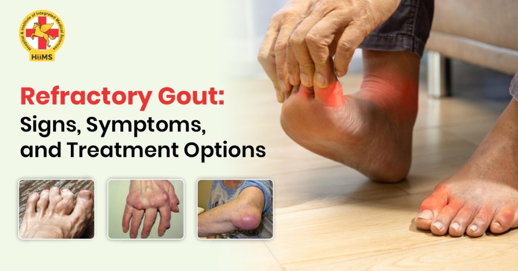 what is Refractory gout disease