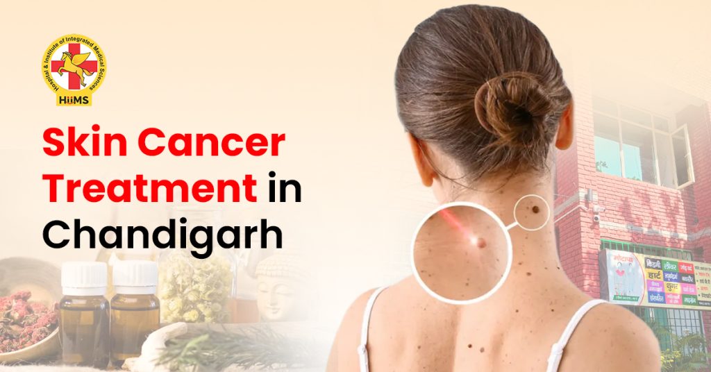 Treatment for Skin Cancer
