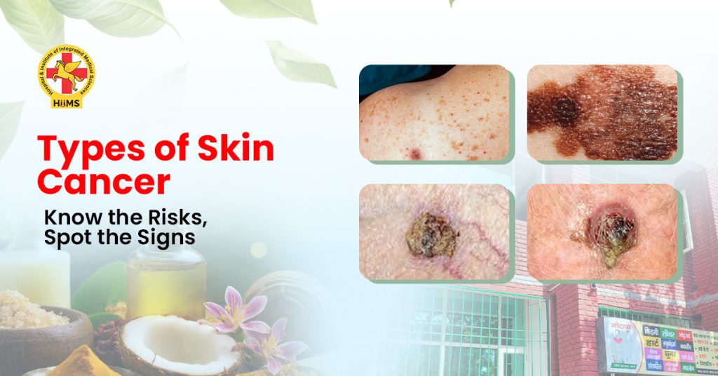 Types of Skin Cancer
