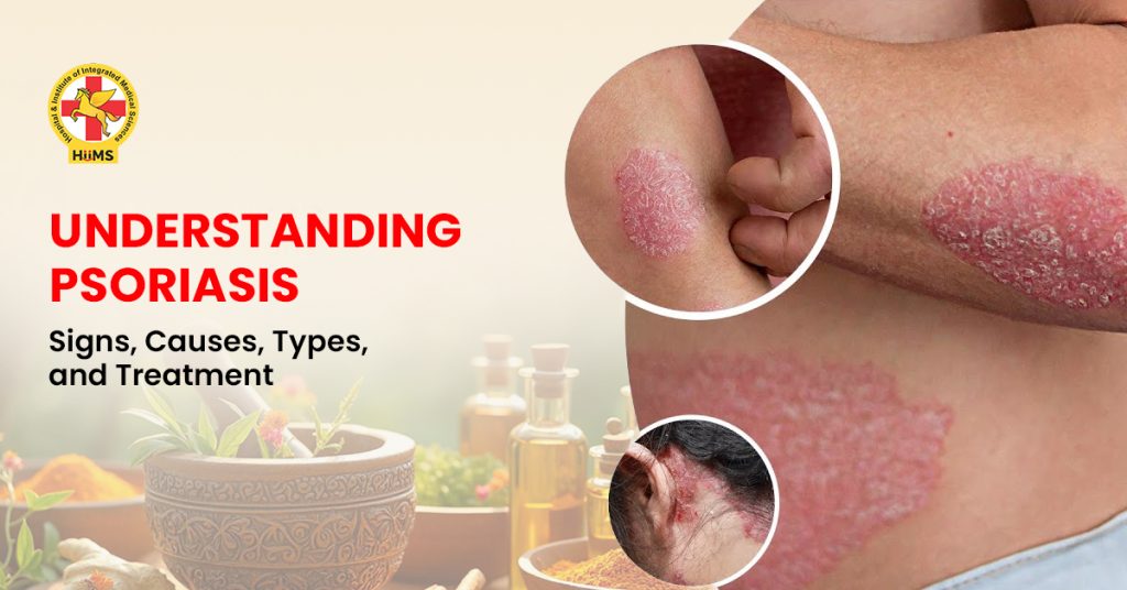 Understanding Psoriasis Signs, Causes, Types, and Treatment