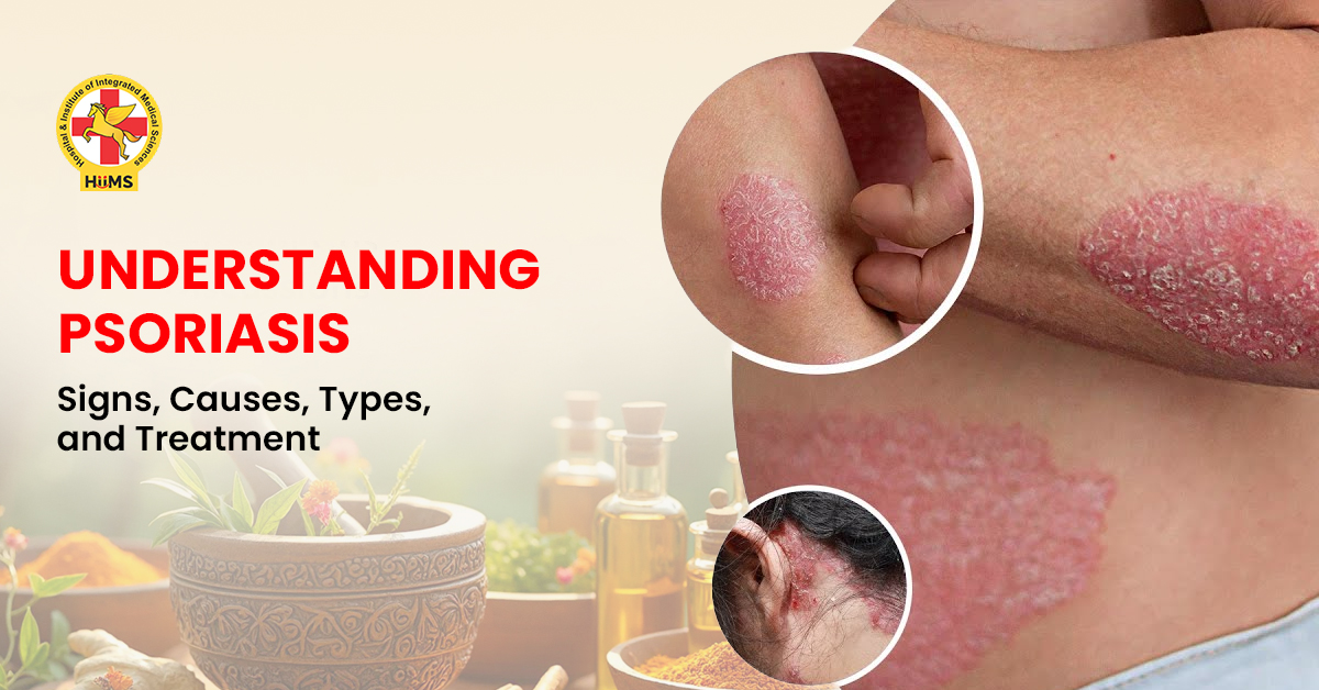 Understanding Psoriasis Signs, Causes, Types, and Treatment