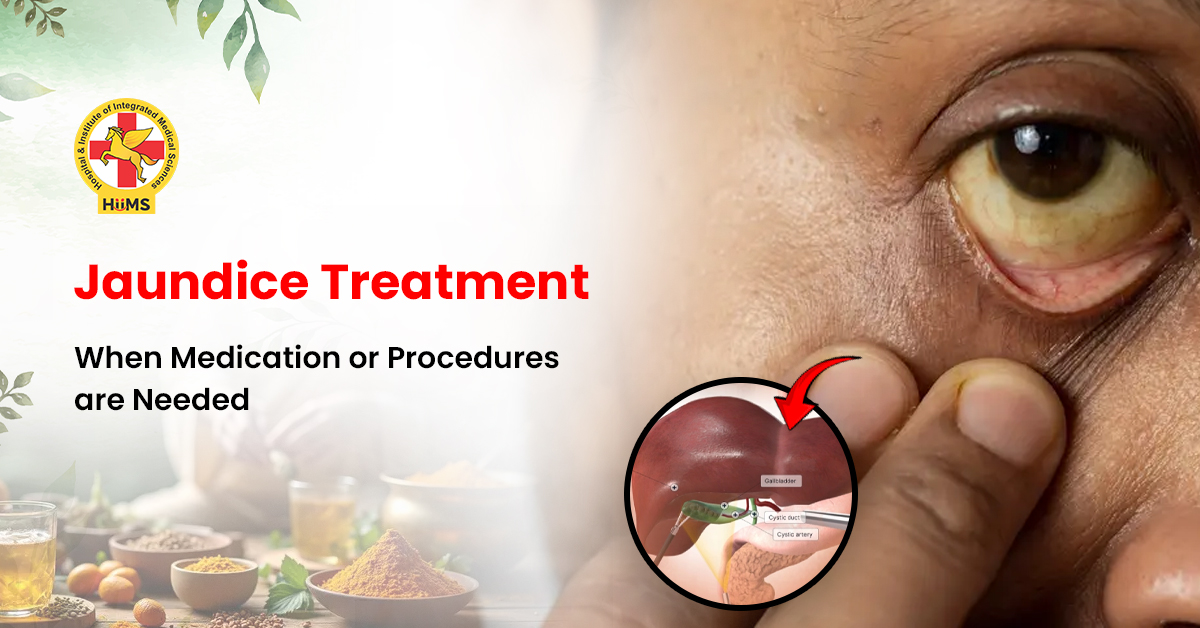 jaundice disease treatment