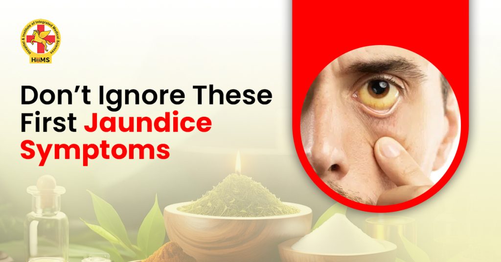 Symptoms of Jaundice