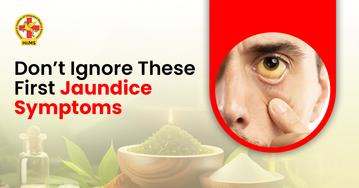 Symptoms of Jaundice