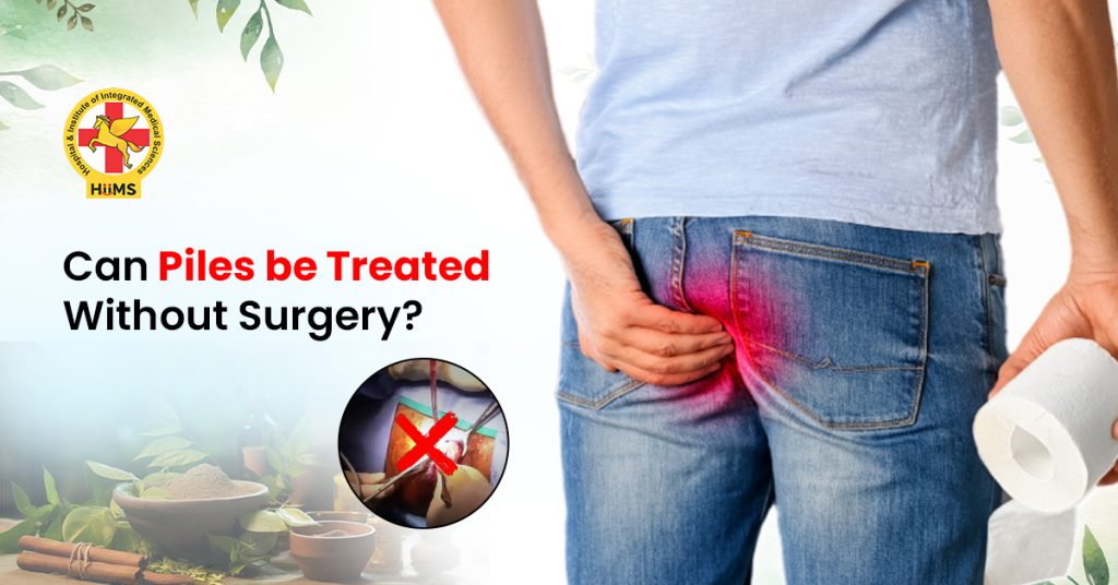 Can Piles be Treated without Surgery
