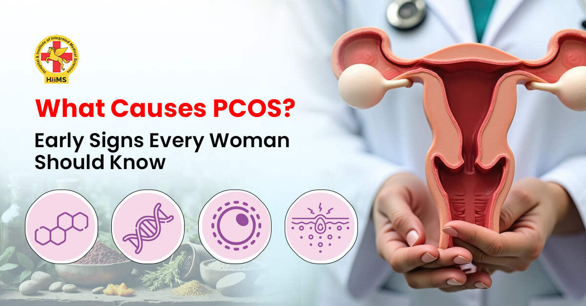 Causes PCOS