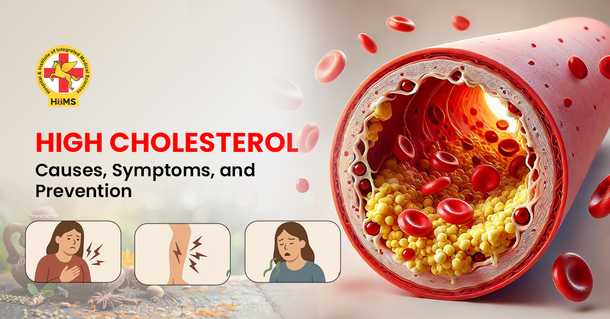 causes of high cholesterol