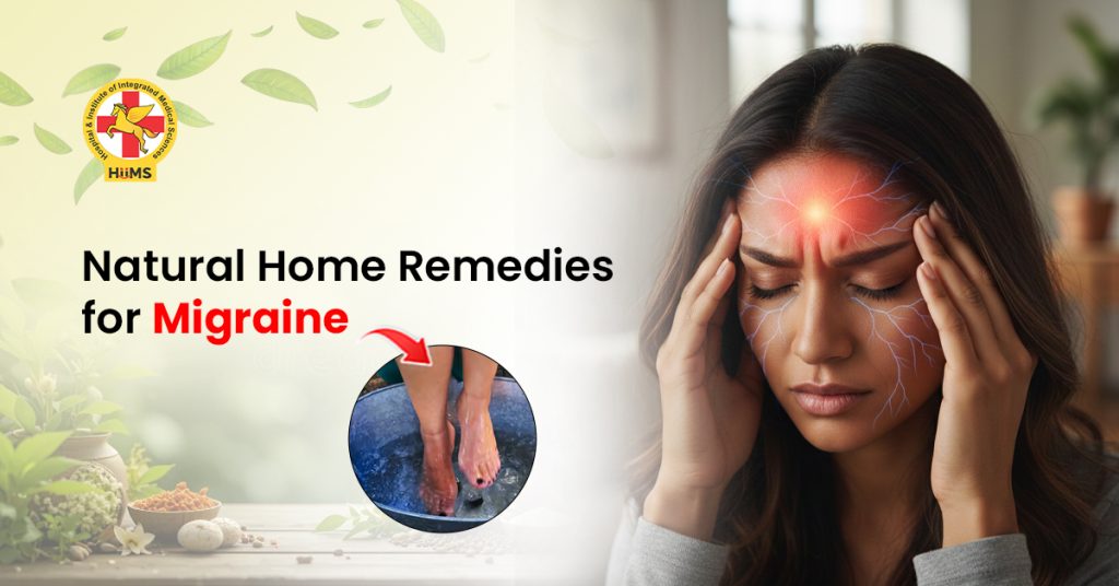 migraine treatment at home