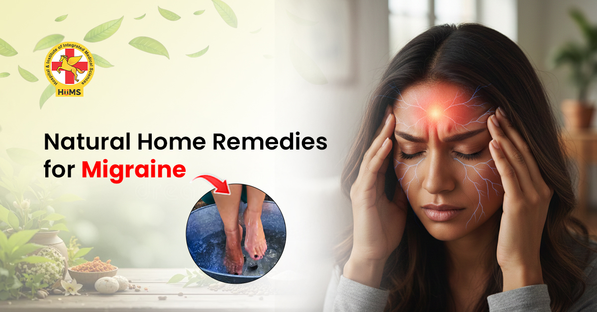 migraine treatment at home