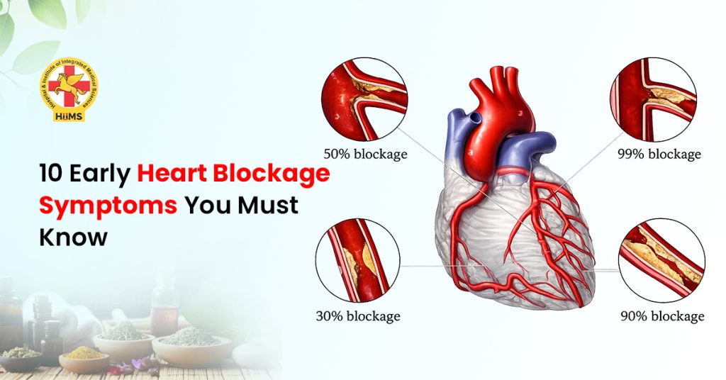 10 Early Heart Blockage Symptoms You Must Know