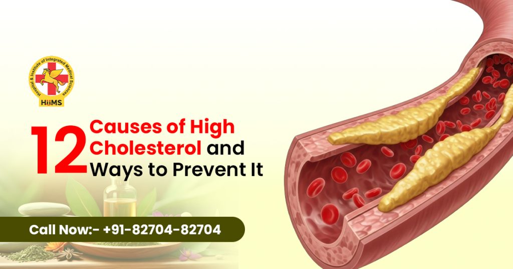 Causes of High Cholesterol