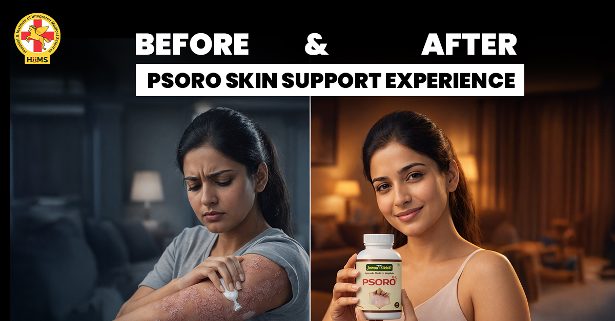 ayurvedic psoriasis tablets for natural skin treatment