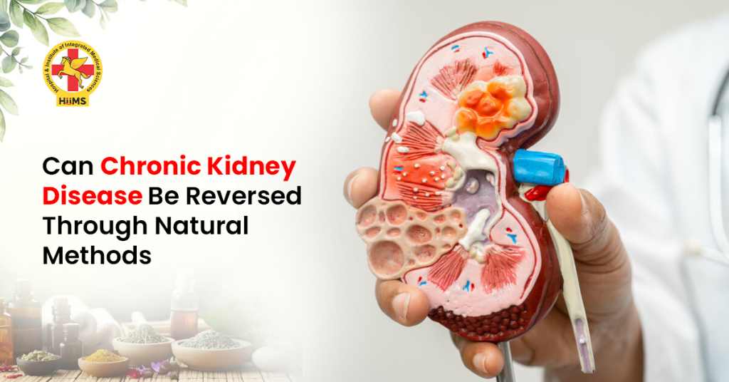 Diagram explaining stages of chronic kidney disease progression