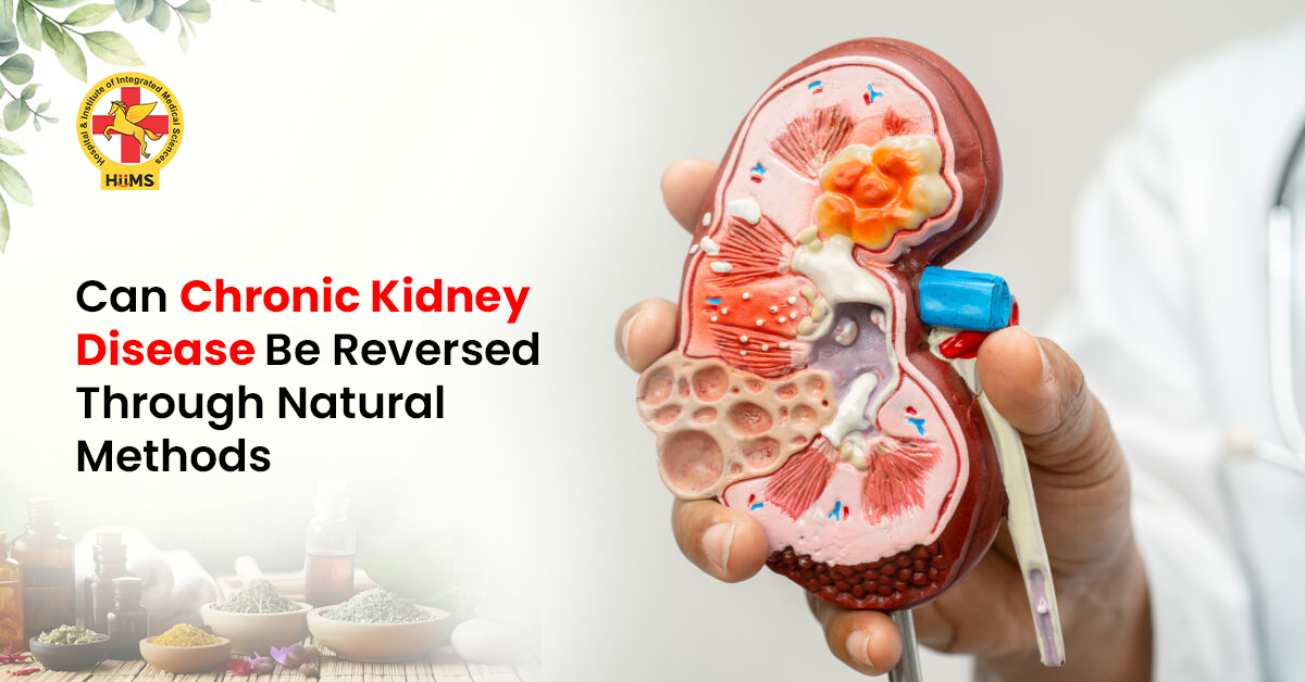 Diagram explaining stages of chronic kidney disease progression
