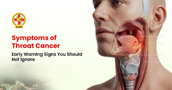 Symptoms of Throat Cancer