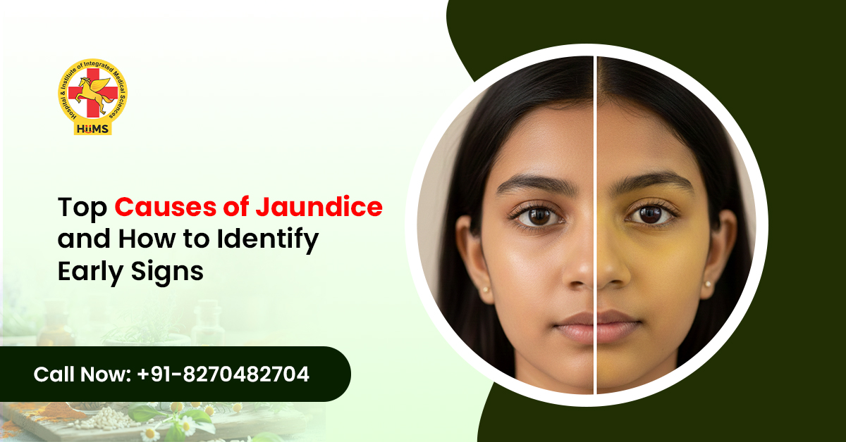 Top Causes of Jaundice