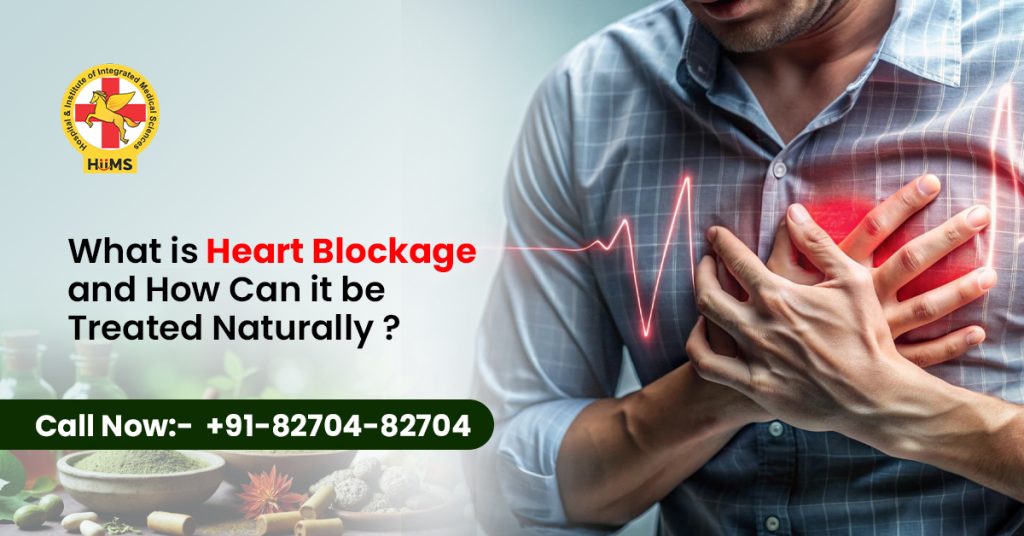 What Is Heart Blockage and How Can It Be Treated Naturally