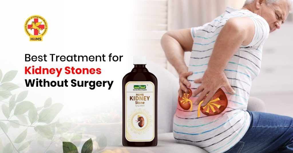 Best Treatment for Kidney Stones Without Surgery
