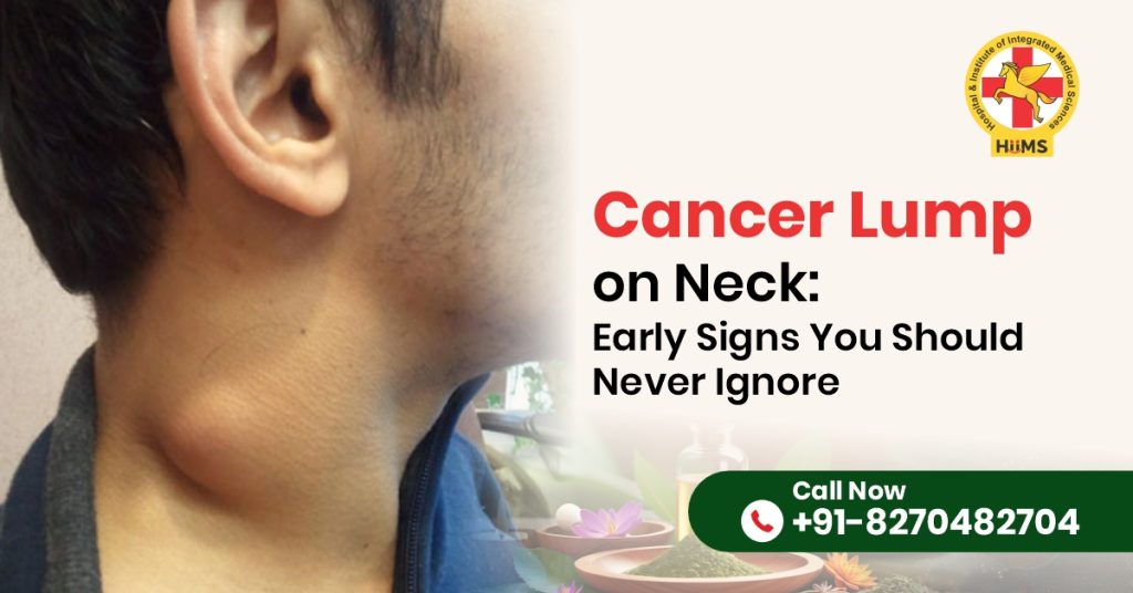 Cancer Lump on Neck