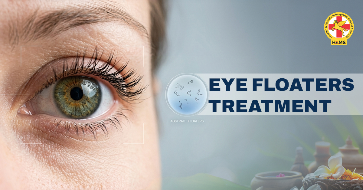 eye floaters