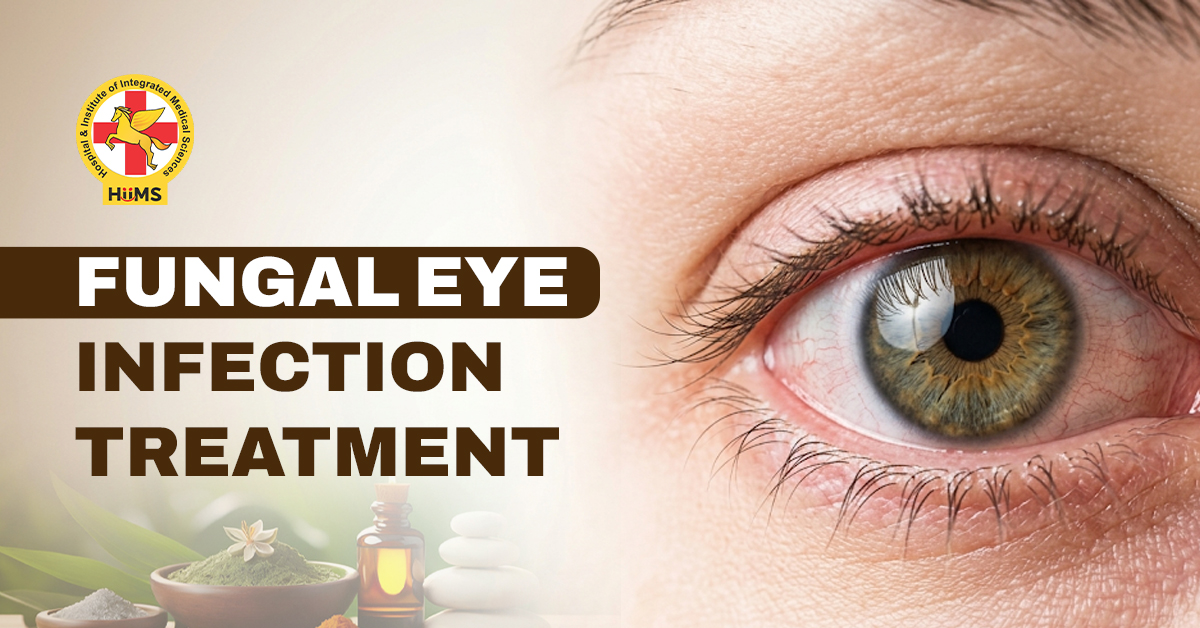 Fungal eye infection
