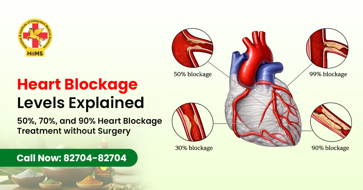 Heart Blockage Levels Explained 50%, 70%, and 90% Heart Blockage Treatment without Surgery