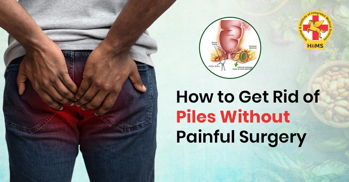 How to Get Rid of Piles Without Painful Surgery
