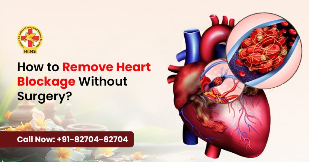 How to Remove Heart Blockage Without Surgery