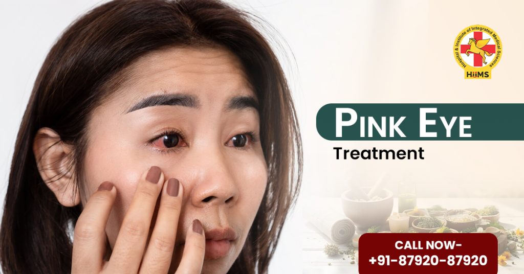 Pink eye treatment