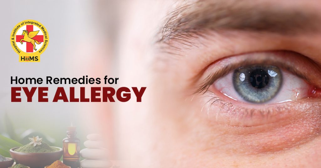 Home remedies for eye allergy