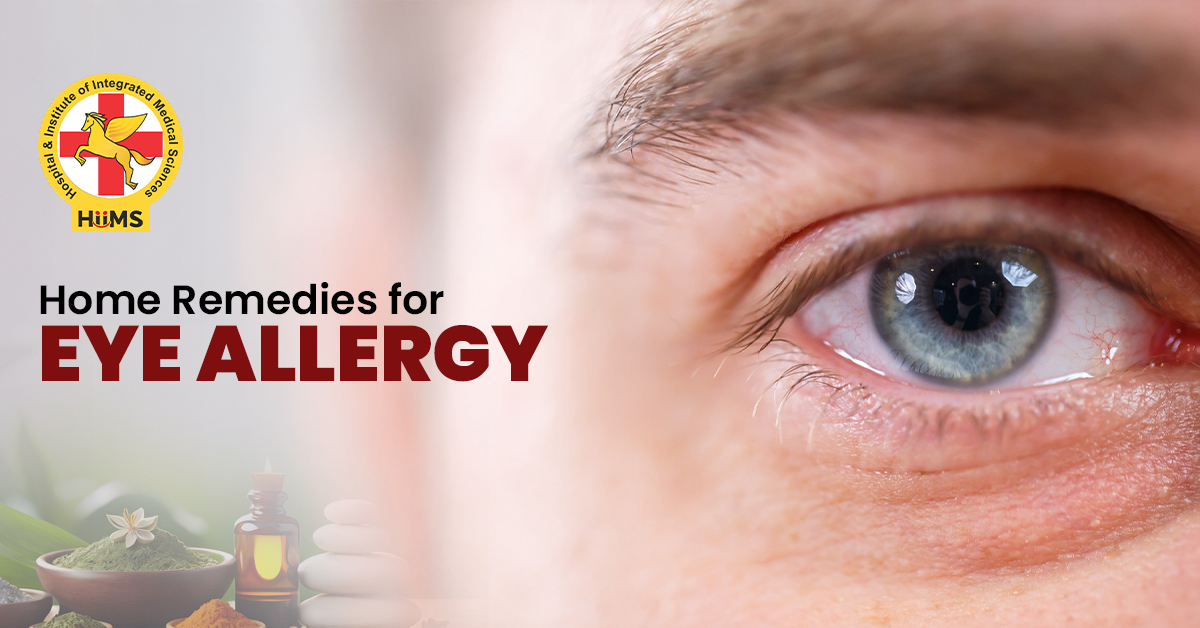 Home remedies for eye allergy