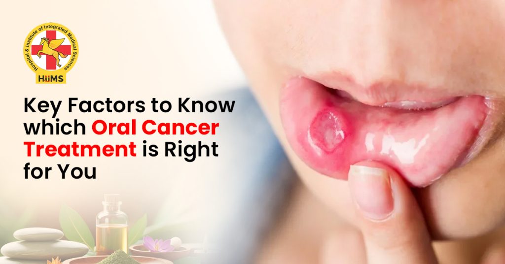 Key Factors to Know which Oral Cancer Treatment Is Right for You