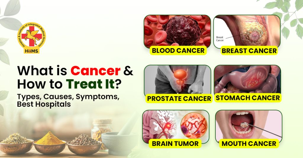 What is Cancer and How to Treat It