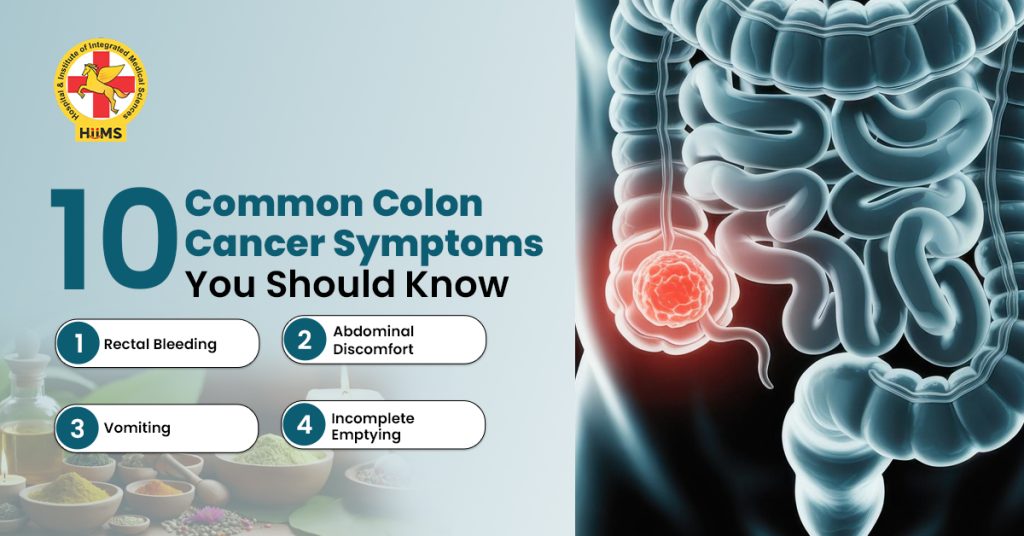 10 Common Colon Cancer Symptoms You Should Know