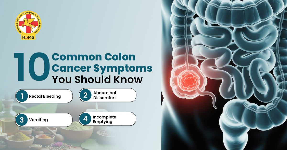 10 Common Colon Cancer Symptoms You Should Know