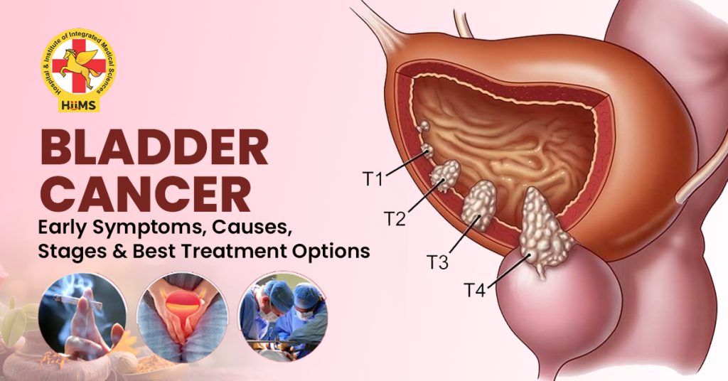 Bladder Cancer treatment