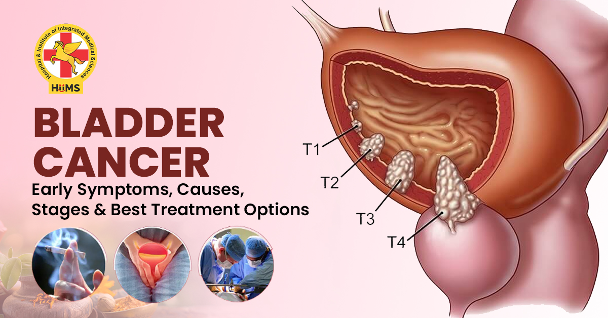 Bladder Cancer treatment