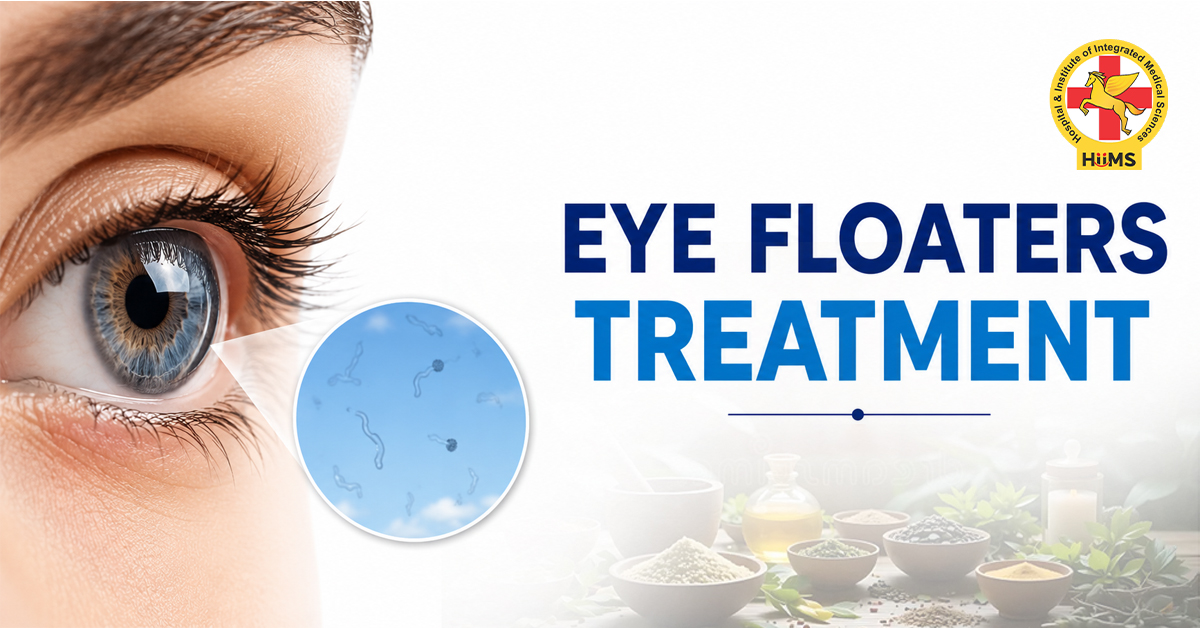 eye floaters treatment