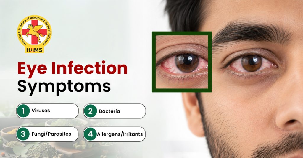 Eye infection signs