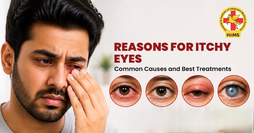 Reasons for Itchy Eyes