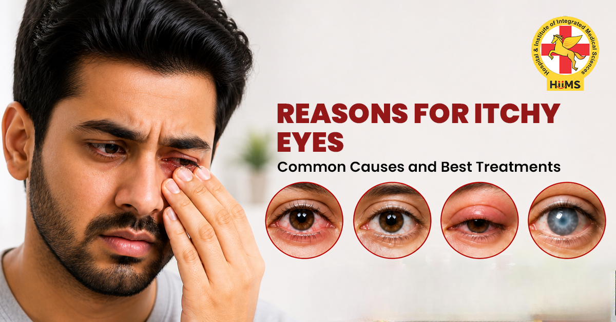 Reasons for Itchy Eyes