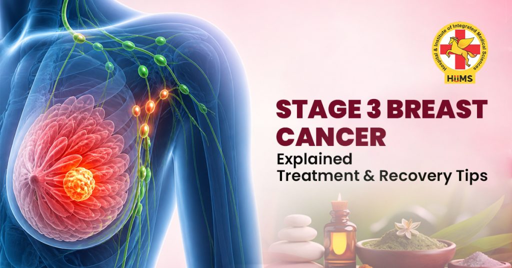 Stage 3 Breast Cancer