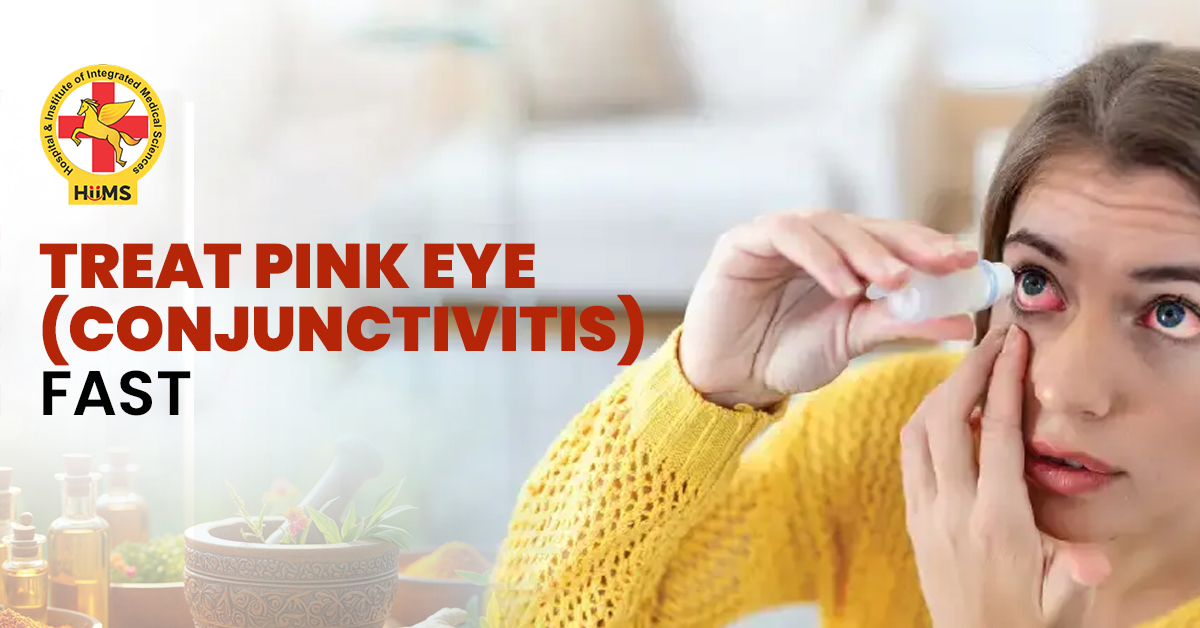 How to treat pink eye