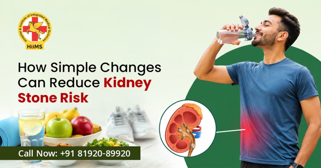 Doctor explaining kidney stone treatment to a patient
